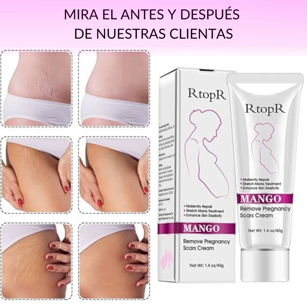 Crema Antiestrías KARAITI