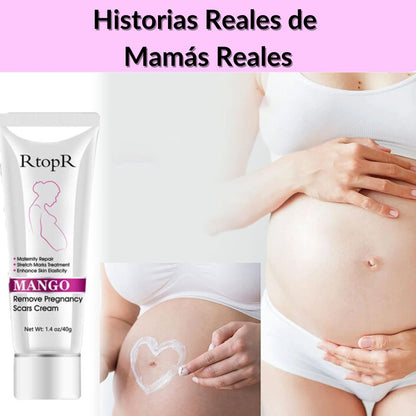 Crema Antiestrías KARAITI