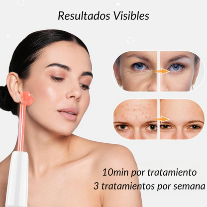 Varita Facial Alta Frecuencia